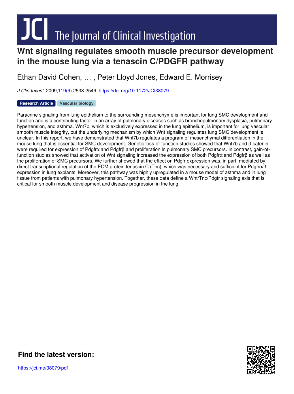 Wnt Signaling Regulates Smooth Muscle Precursor Development in the Mouse Lung Via a Tenascin C/PDGFR Pathway