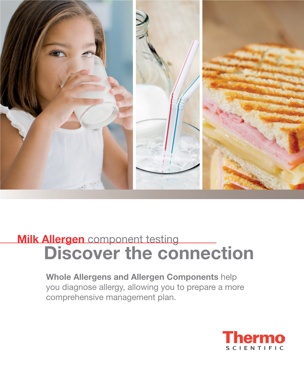 Milk Allergen Component Testing Discover the Connection