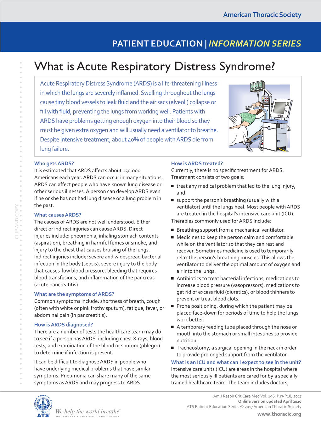 What Is Acute Respiratory Distress Syndrome?