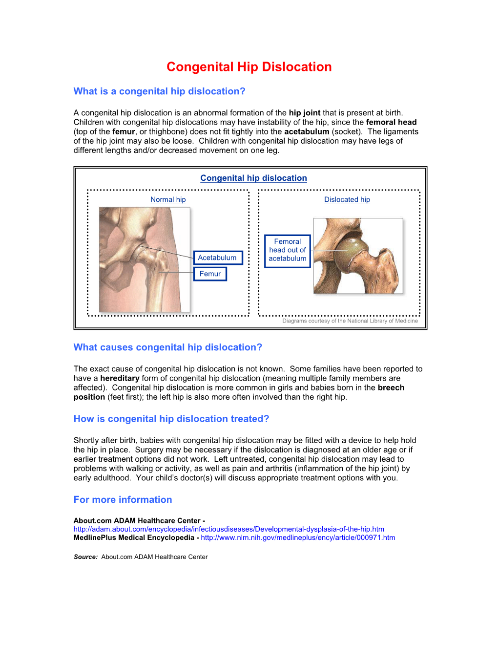 Congenital Hip Dislocation