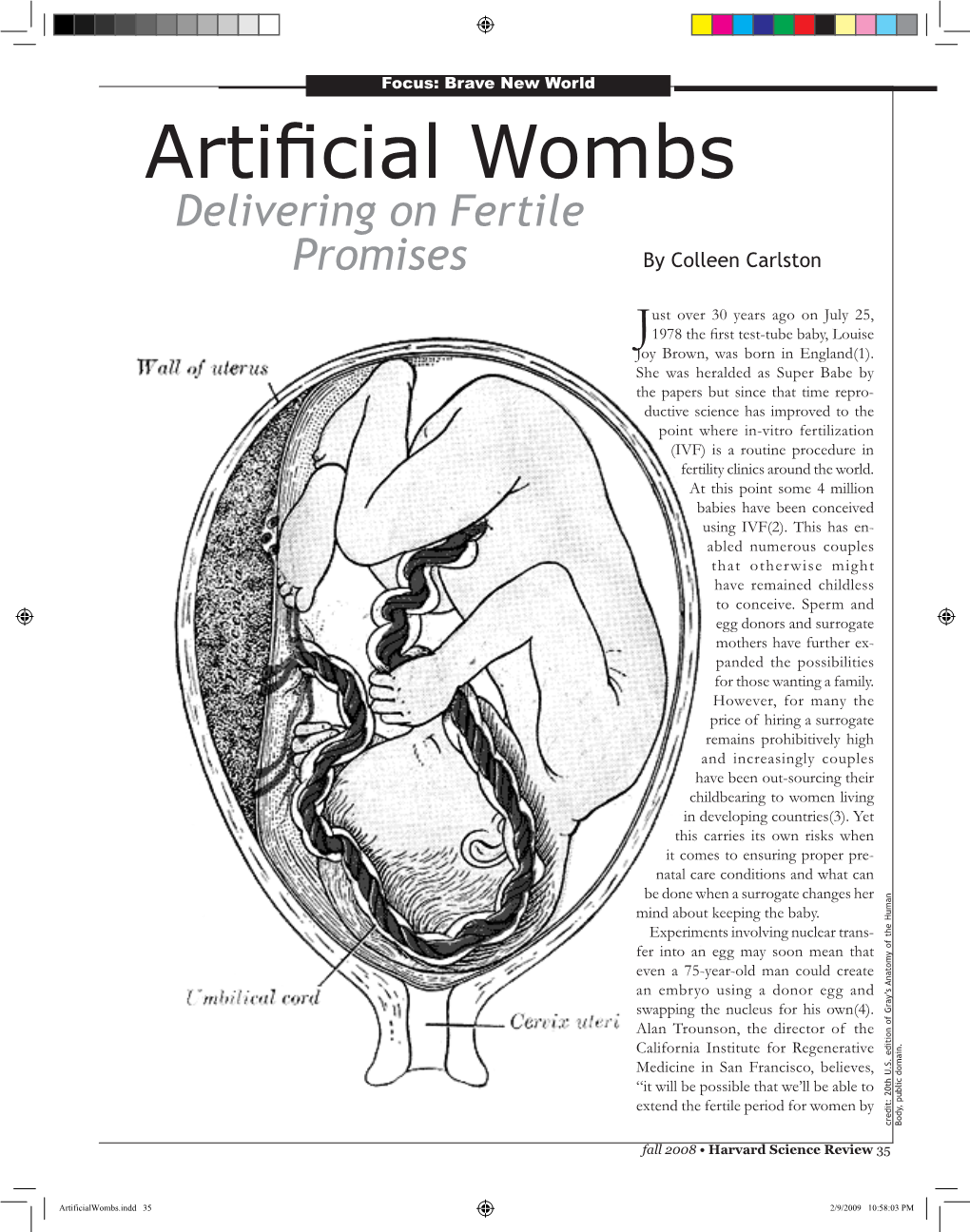 Artificial Wombs Delivering on Fertile Promises by Colleen Carlston