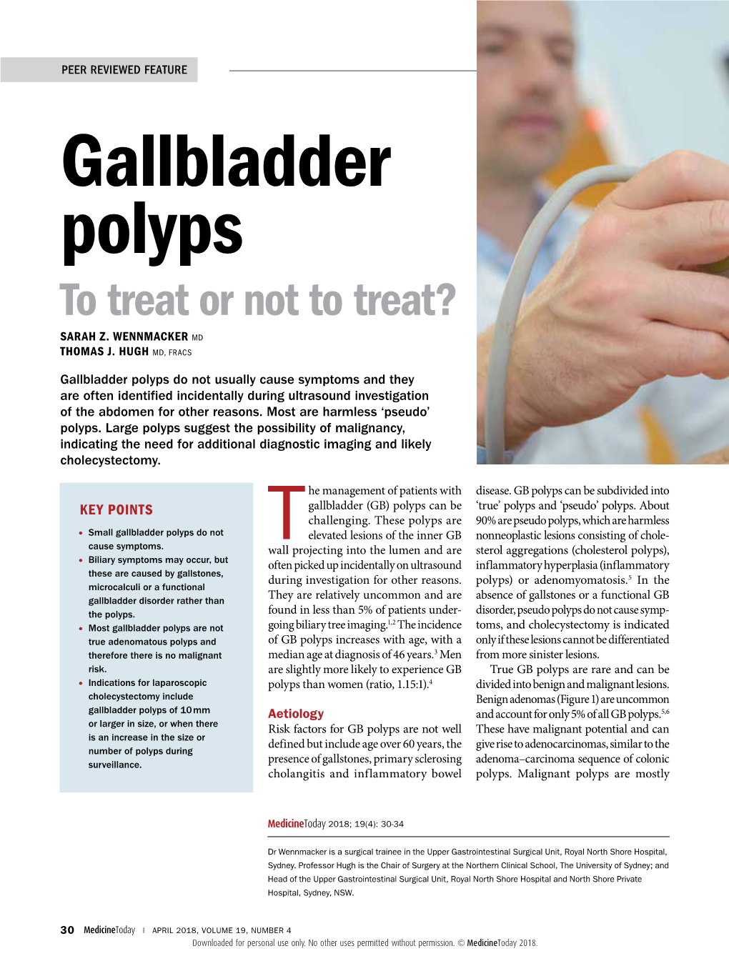 Gallbladder Polyps to Treat Or Not to Treat? SARAH Z