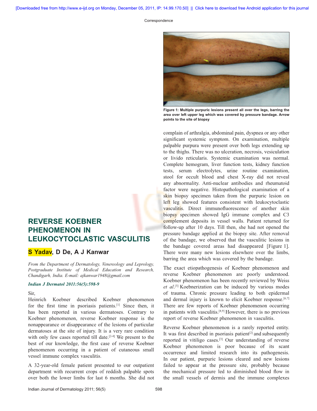 Reverse Koebner Phenomenon in Vasculitis