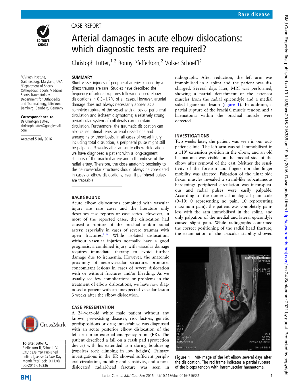 Arterial Damages in Acute Elbow Dislocations: Which Diagnostic Tests Are Required? Christoph Lutter,1,2 Ronny Pfefferkorn,2 Volker Schoefﬂ2