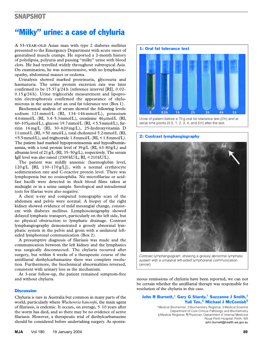 SNAPSHOT SNAPSHOT “Milky” Urine: a Case of Chyluria