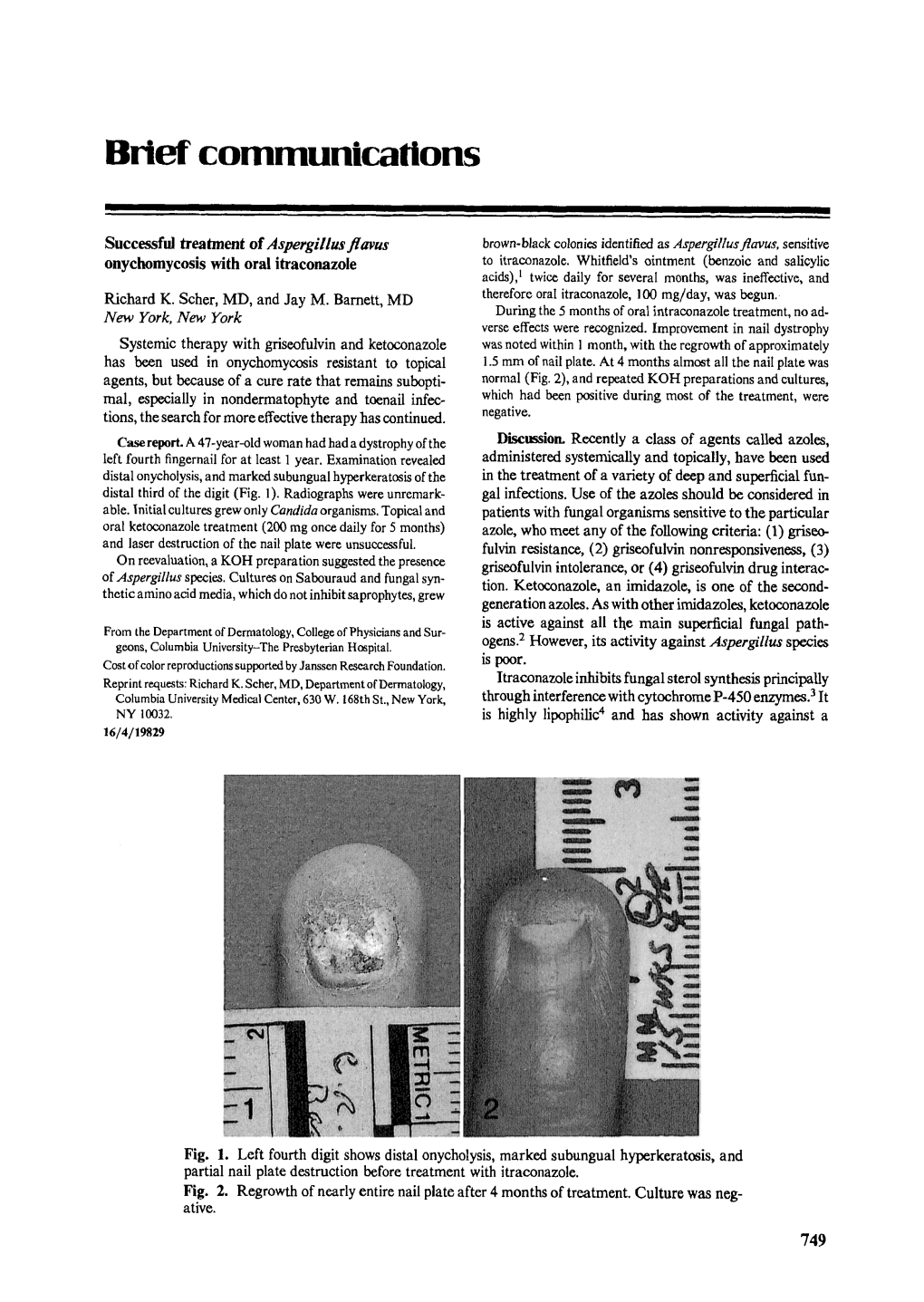 Successful Treatment of Aspergillus Flavus Onychomycosis with Oral