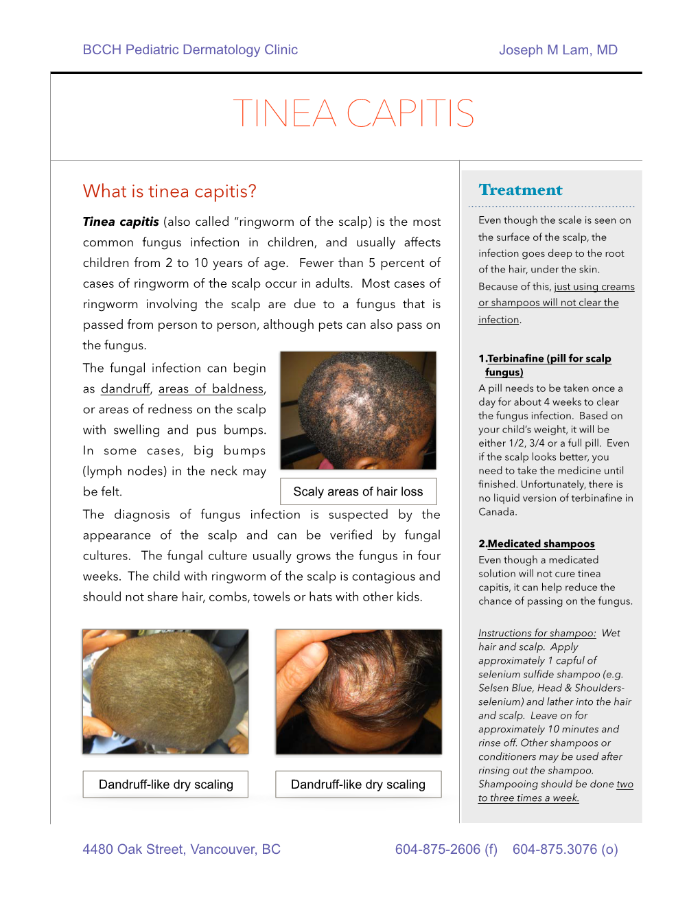 Tinea Capitis