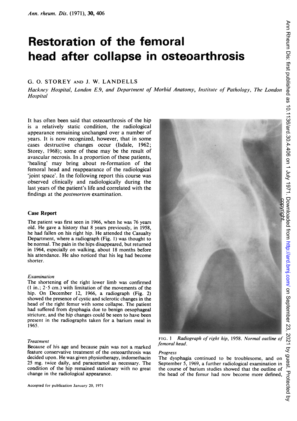 Restoration of the Femoral Head After Collapse in Osteoarthrosis