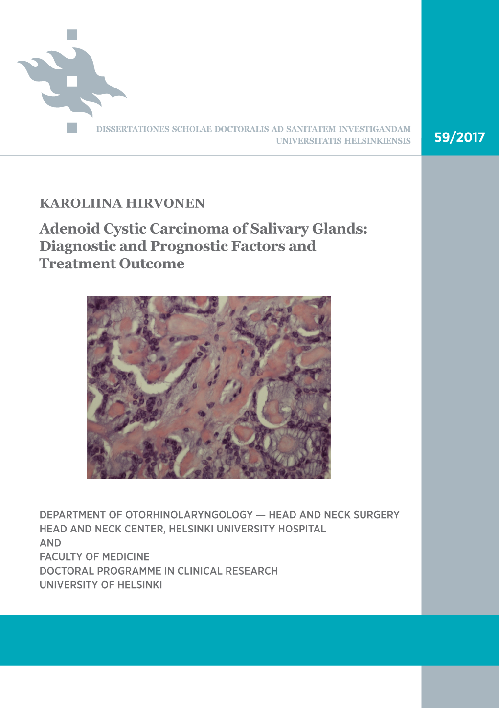 Adenoid Cystic Carcinoma of Salivary Glands - Diagnostic and Prognostic Factors and Treatment Outcome Recent Publications in This Series