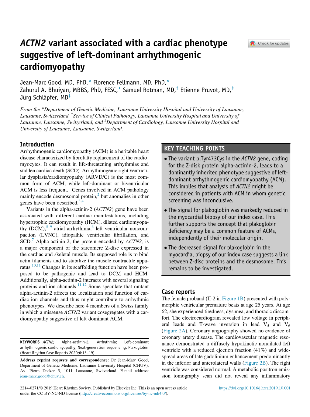 ACTN2 Variant Associated with a Cardiac Phenotype Suggestive of Left-Dominant Arrhythmogenic Cardiomyopathy