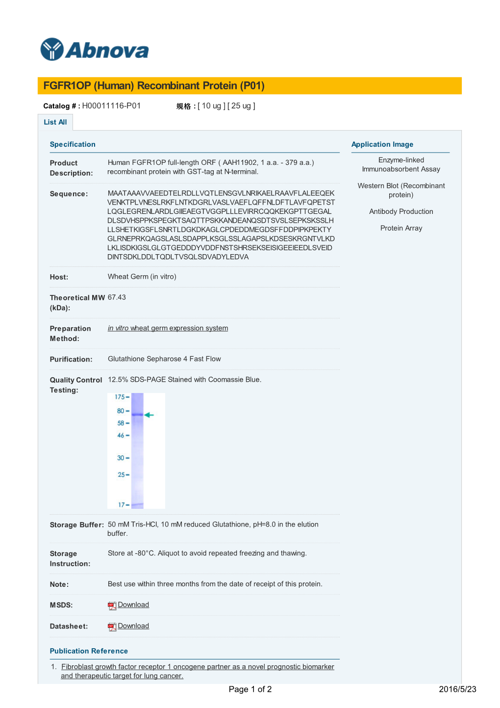 FGFR1OP (Human) Recombinant Protein (P01)