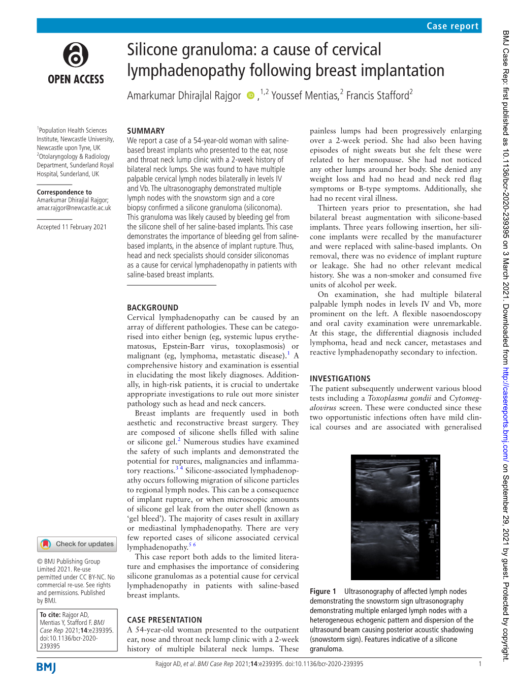 Silicone Granuloma: a Cause of Cervical Lymphadenopathy Following Breast Implantation Amarkumar Dhirajlal Rajgor ‍ ‍ ,1,2 Youssef Mentias,2 Francis Stafford2