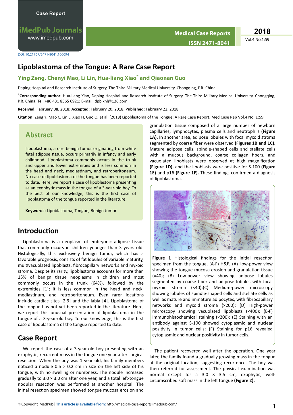 Lipoblastoma of the Tongue: a Rare Case Report Ying Zeng, Chenyi Mao, Li Lin, Hua-Liang Xiao* and Qiaonan Guo