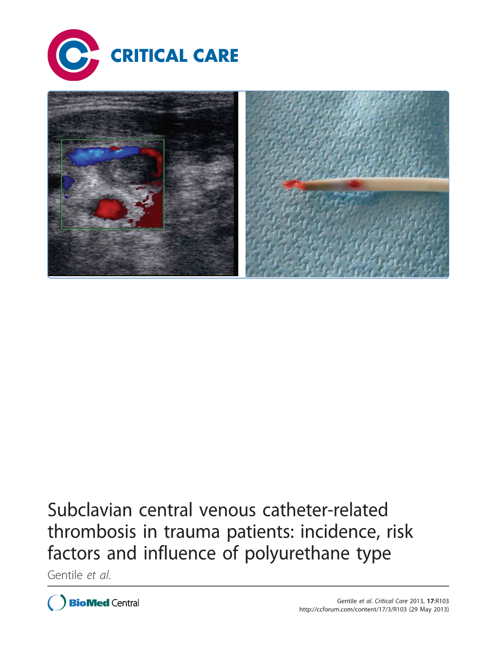 Subclavian Central Venous Catheter-Related Thrombosis in Trauma Patients: Incidence, Risk Factors and Influence of Polyurethane Type Gentile Et Al