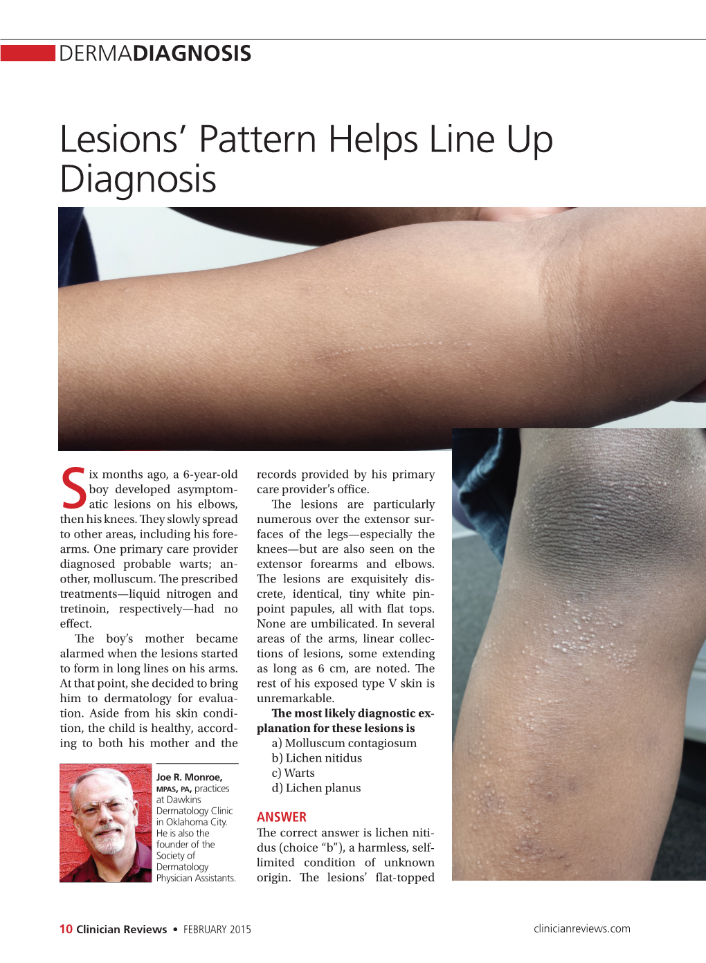 Lesions' Pattern Helps Line up Diagnosis