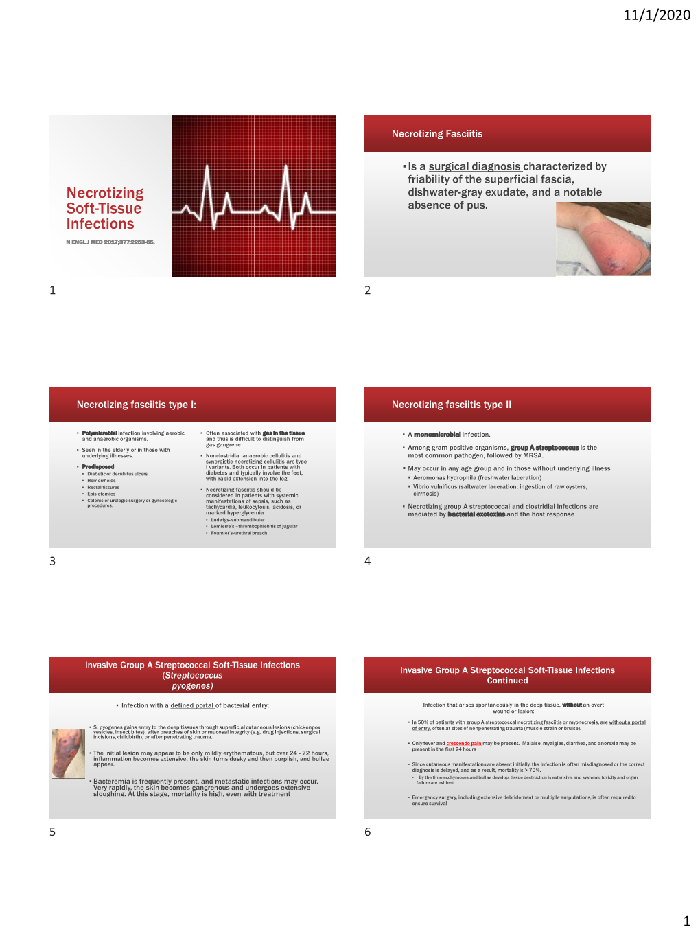 Necrotizing Soft-Tissue Infections