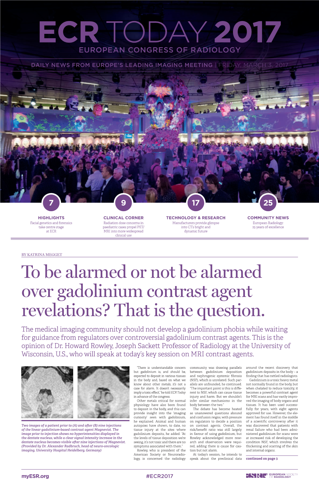 To Be Alarmed Or Not Be Alarmed Over Gadolinium Contrast Agent Revelations? That Is the Question