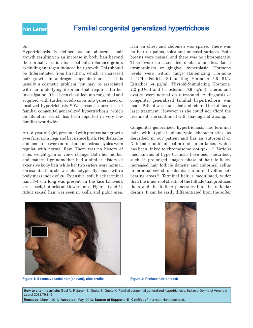 Familial Congenital Generalized Hypertrichosis, Which Laser Treatment