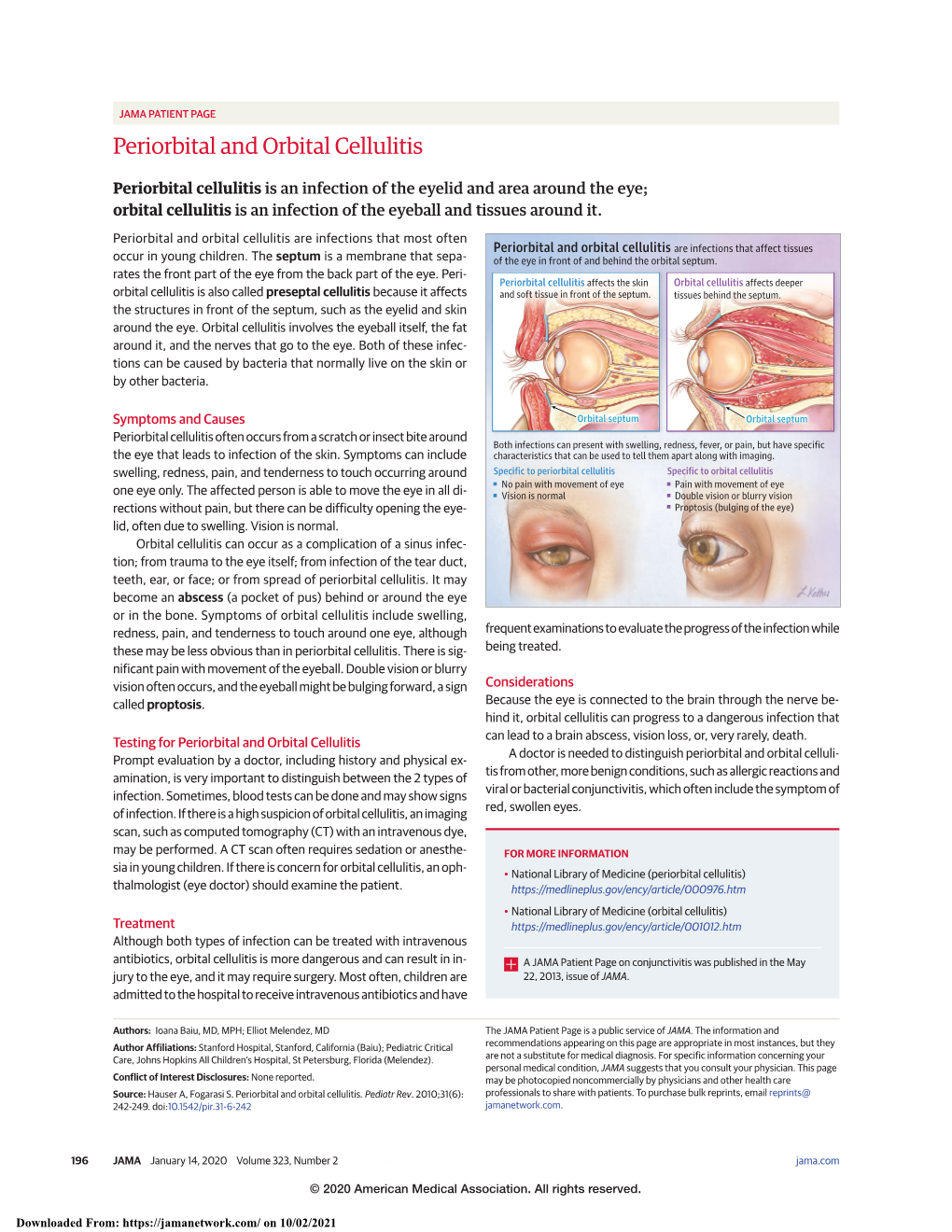 Periorbital and Orbital Cellulitis