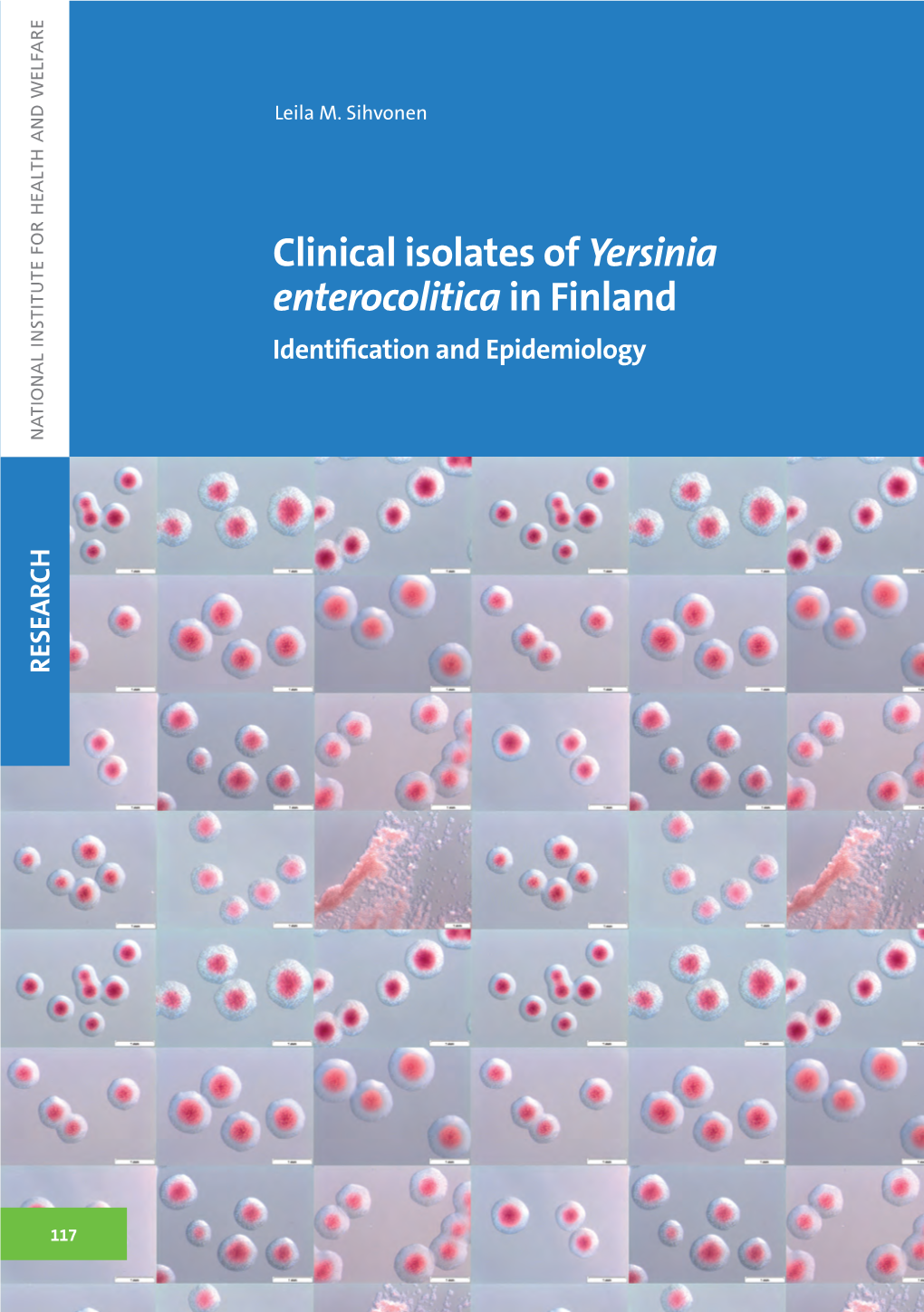 Clinical Isolates of Yersinia Enterocolitica in Finland 117 2013 117