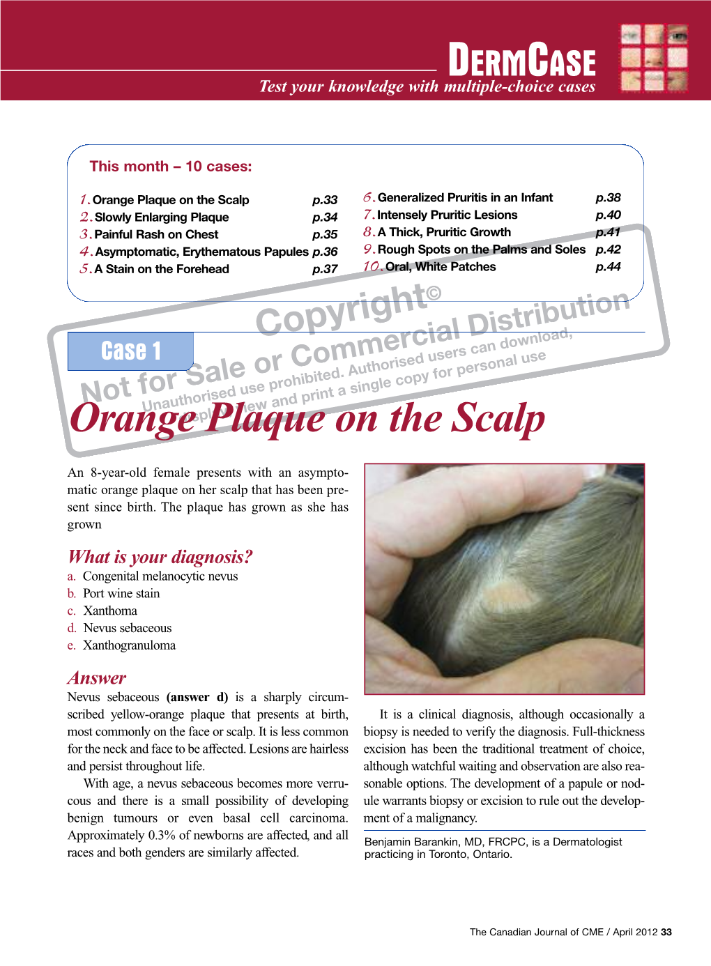 Orange Plaque on the Scalp P.33 6