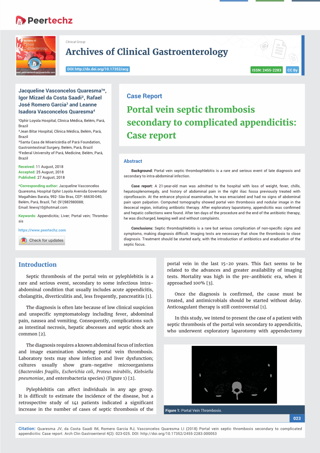 Portal Vein Septic Thrombosis Secondary to Complicated Appendicitis: Case Report