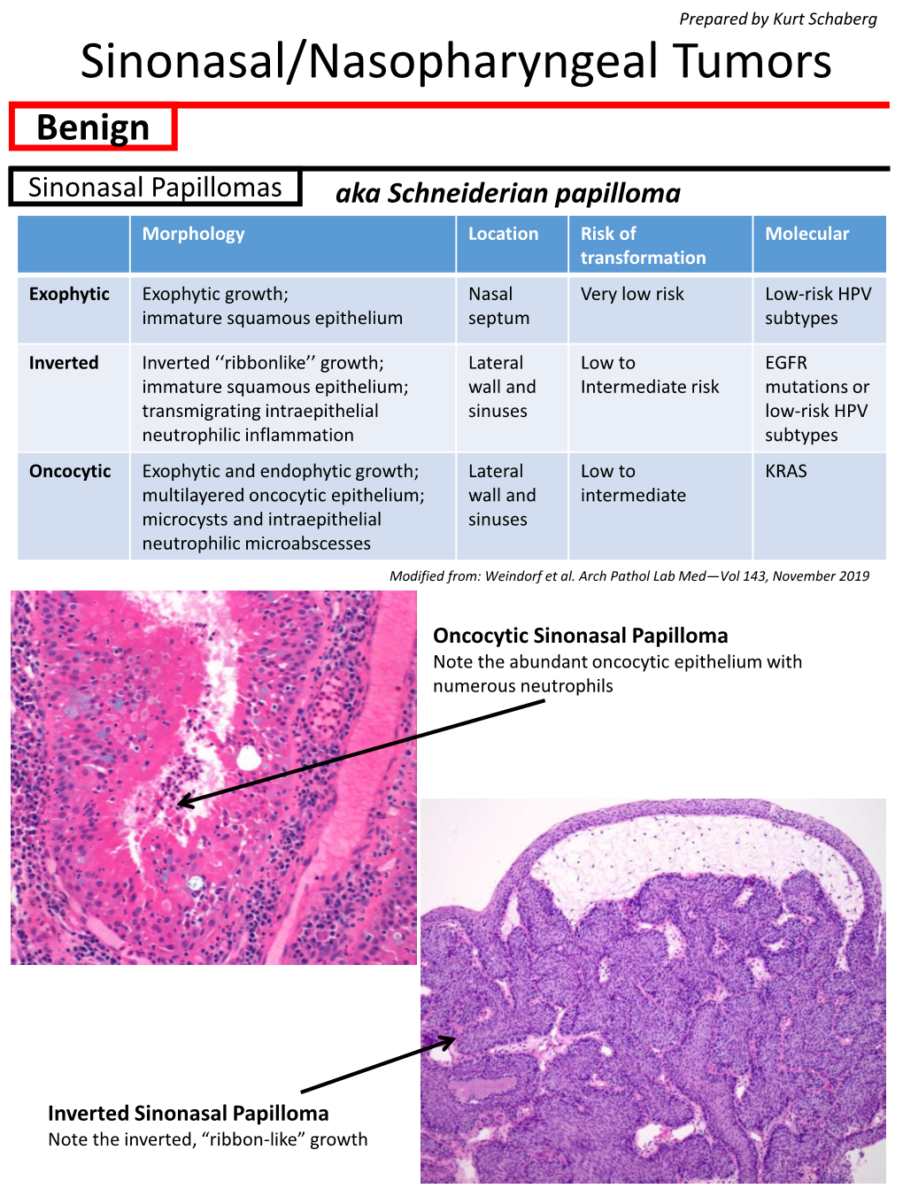 Sinonasal Tumors