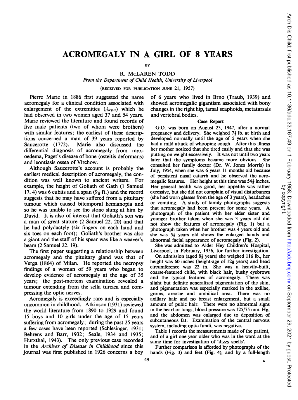 Acromegaly in a Girl of 8 Years