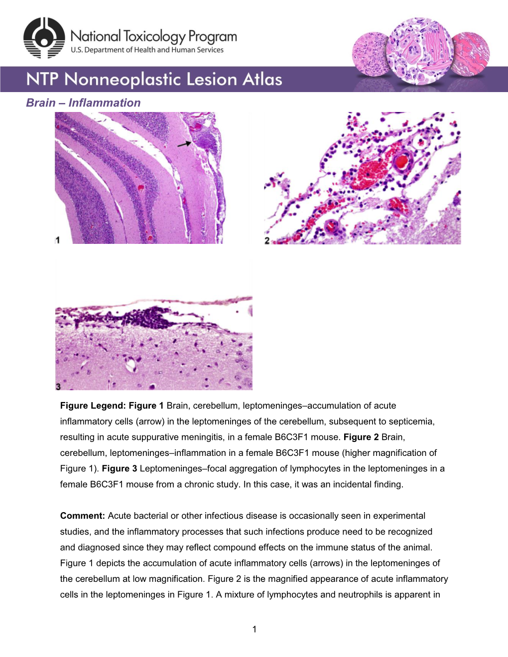 Brain – Inflammation