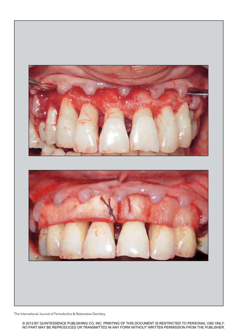 The International Journal of Periodontics & Restorative Dentistry