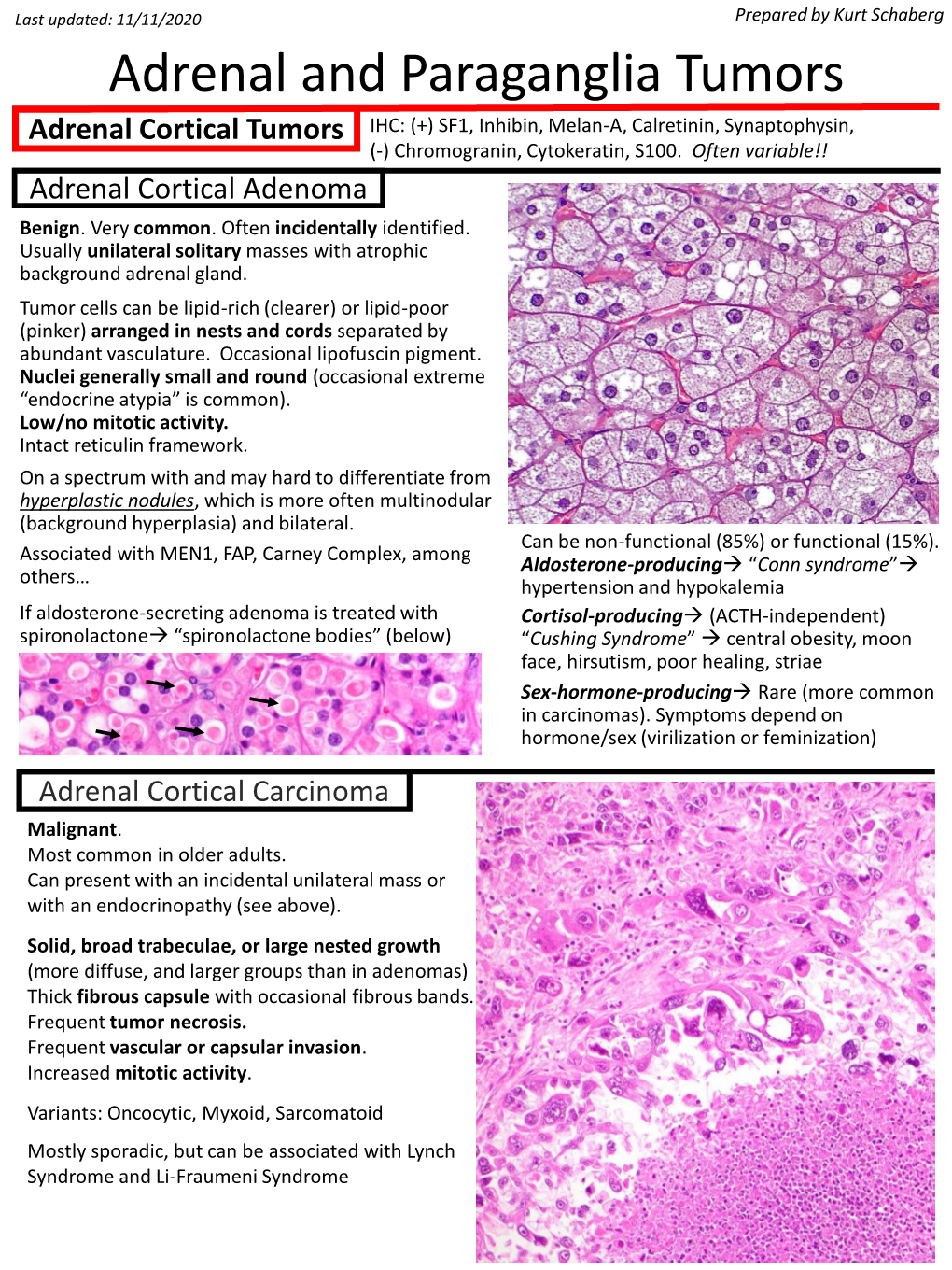 Adrenal and Paraganglia Tumors Adrenal Cortical Tumors IHC: (+) SF1, Inhibin, Melan-A, Calretinin, Synaptophysin, (-) Chromogranin, Cytokeratin, S100