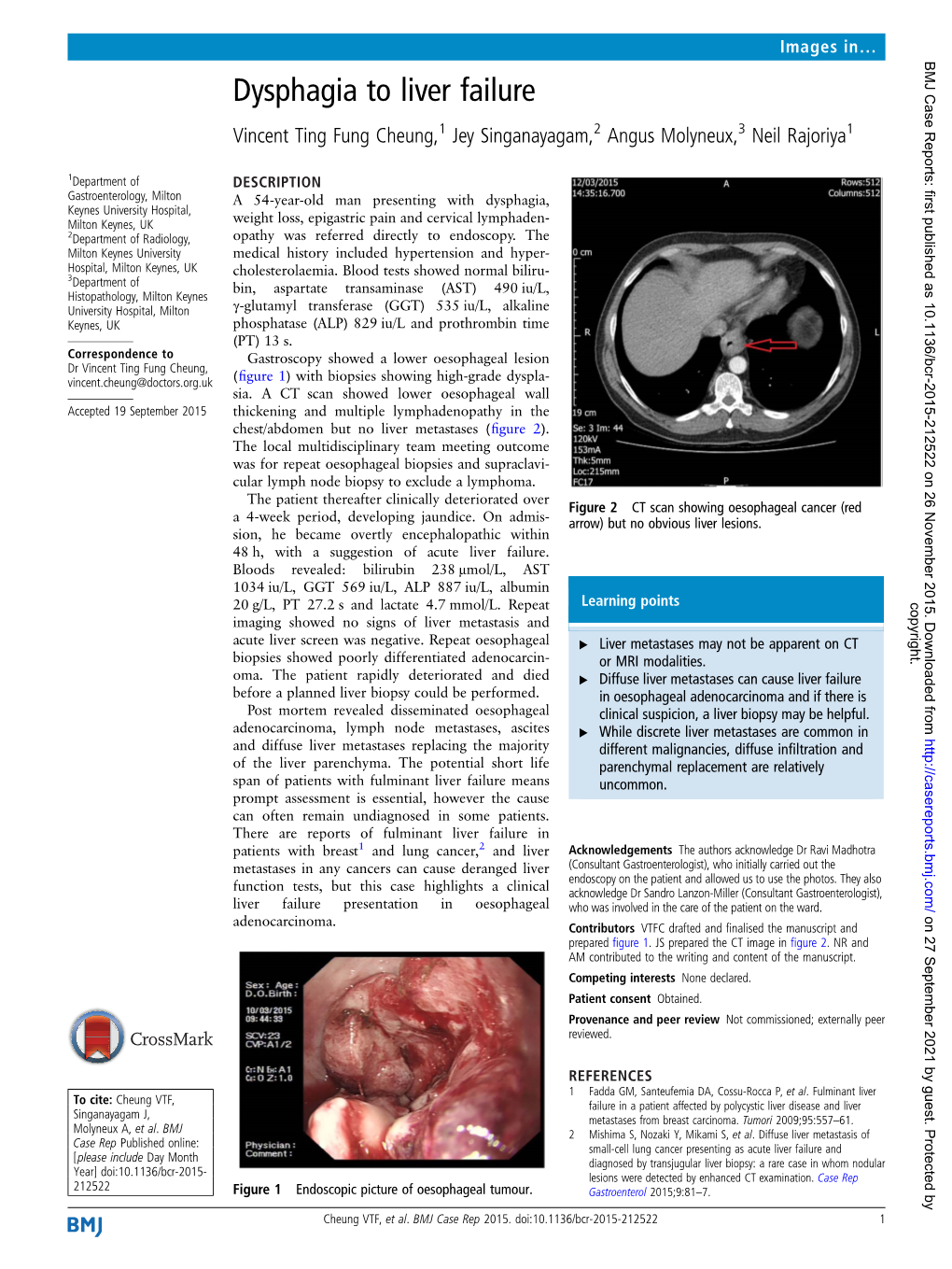 Dysphagia to Liver Failure Vincent Ting Fung Cheung,1 Jey Singanayagam,2 Angus Molyneux,3 Neil Rajoriya1