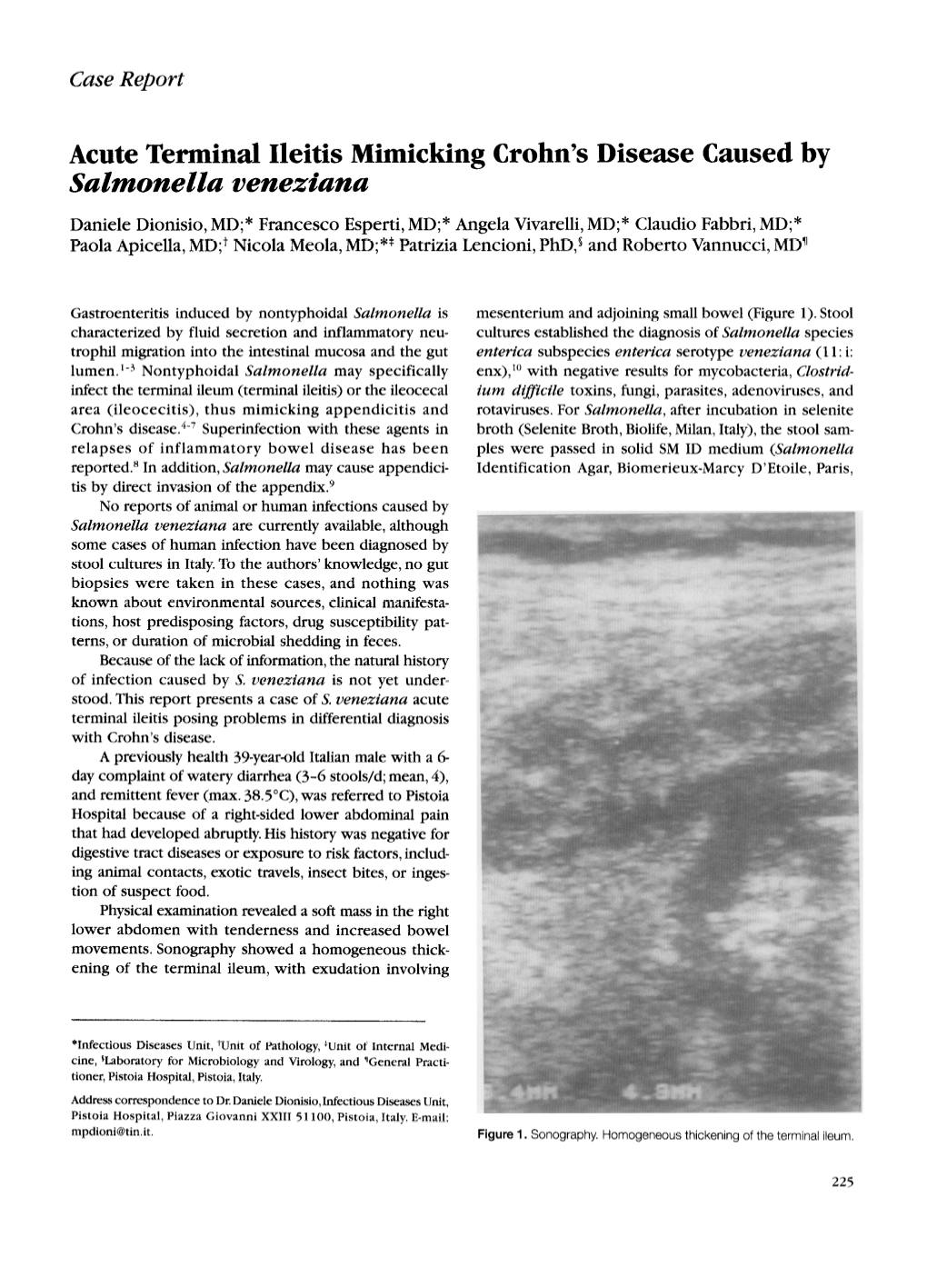 Acute Terminal Ileitis Mimicking Crohn's Disease Caused By