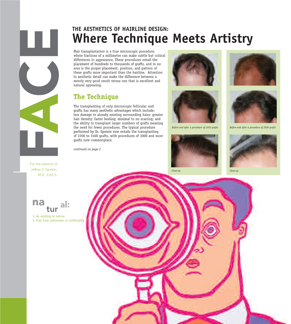 Where Technique Meets Artistry Hair Transplantation Is a True Microscopic Procedure, Where Fractions of a Millimeter Can Make Subtle but Critical