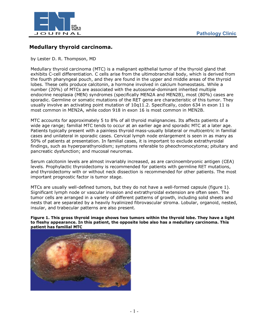 Pathology Clinic Medullary Thyroid Carcinoma