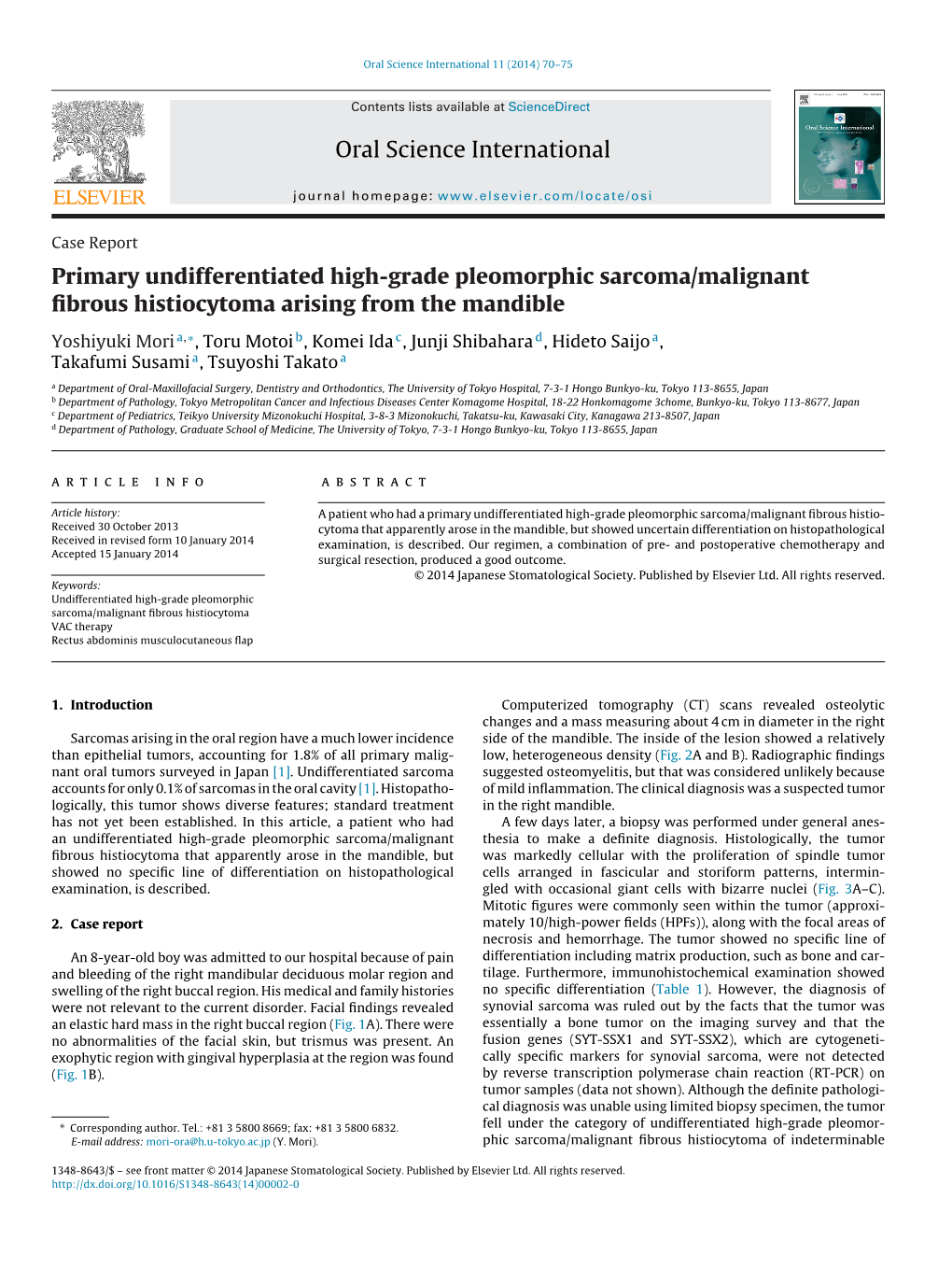 Primary Undifferentiated High-Grade Pleomorphic Sarcoma/Malignant