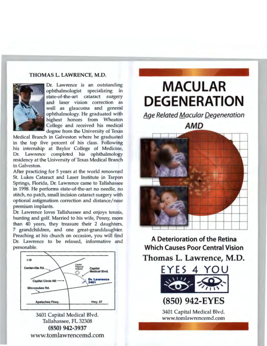 Macular Degeneration