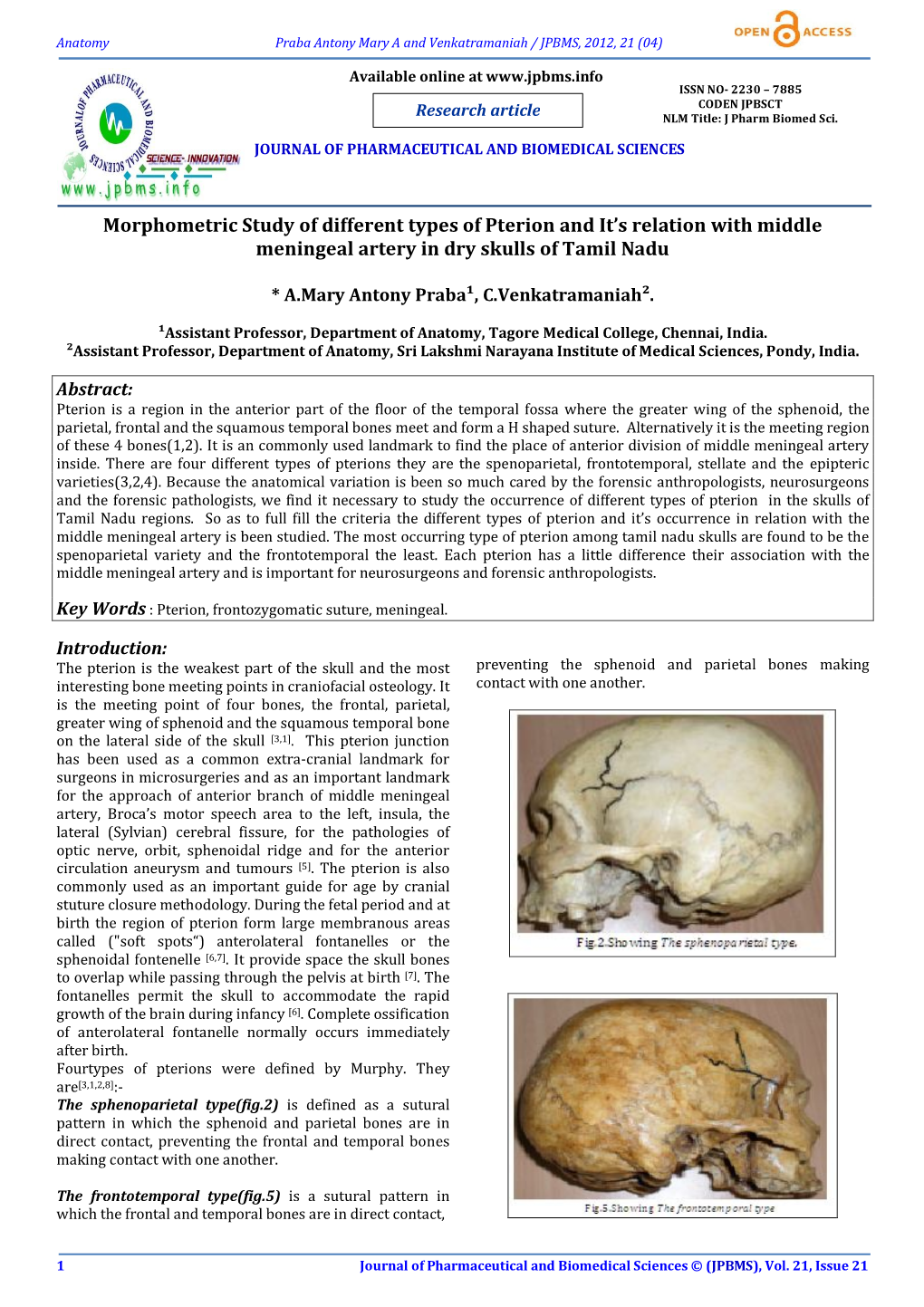 Morphometric Study of Different Types of Pterion and It's Relation With