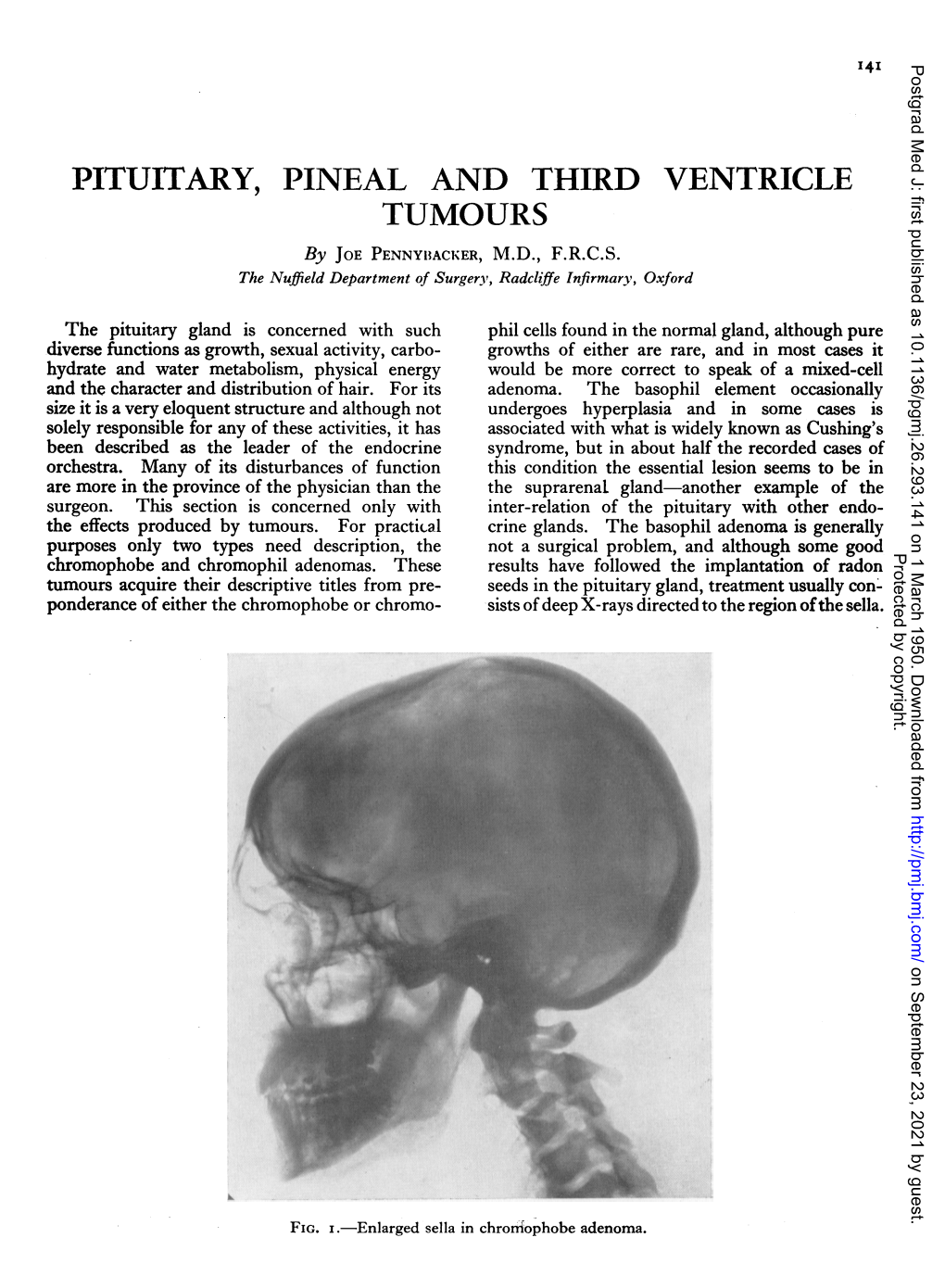 PITUITARY, PINEAL and THIRD VENTRICLE TUMOURS by JOE PENNYIIACKER, M.D., F.R.C.S