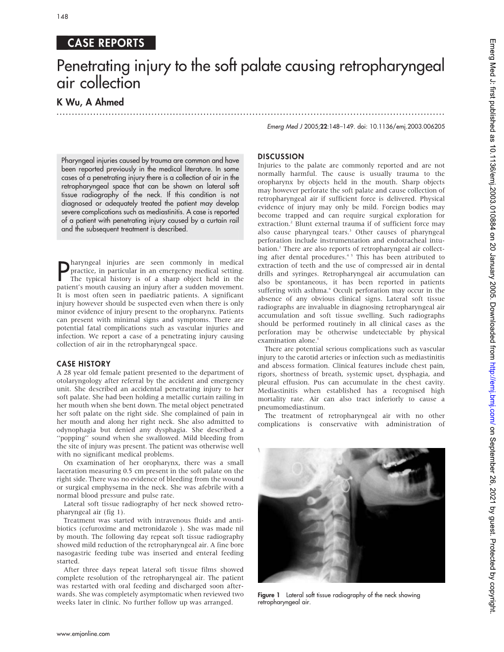 Penetrating Injury to the Soft Palate Causing Retropharyngeal Air Collection K Wu, a Ahmed