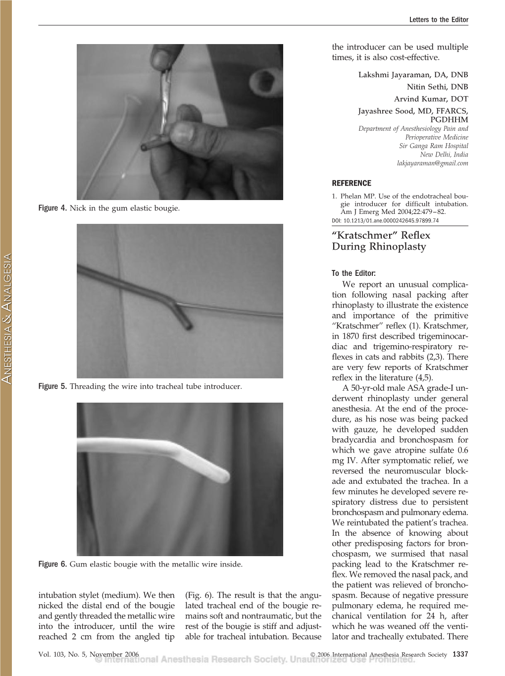 “Kratschmer” Reflex During Rhinoplasty