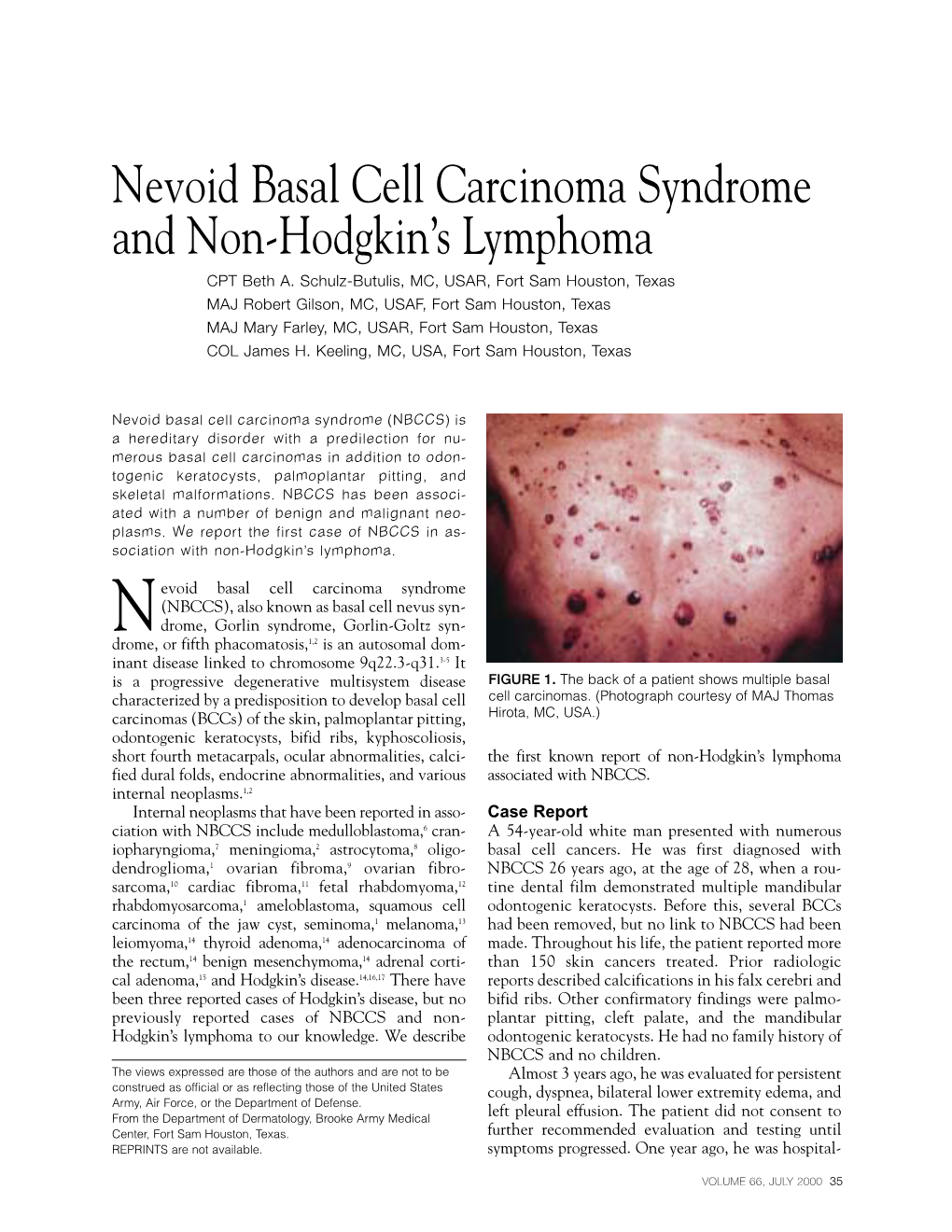 Nevoid Basal Cell Carcinoma Syndrome and Non-Hodgkin's