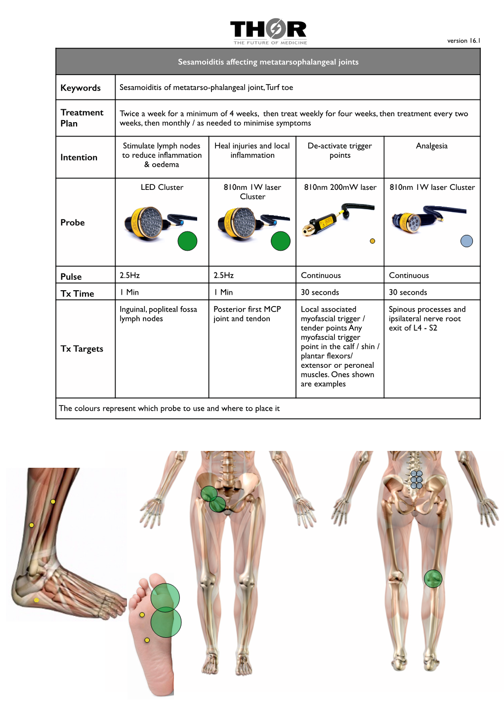 Sesamoiditis MTP Version 16.1.Pages