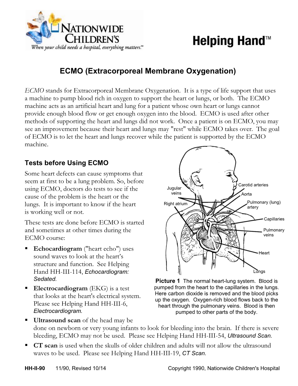 ECMO (Extracorporeal Membrane Oxygenation)