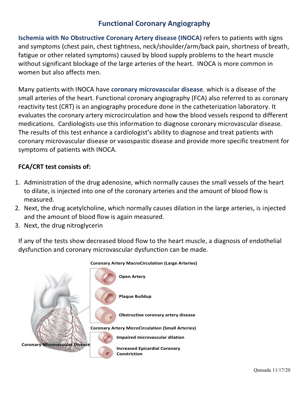 Functional Coronary Angiography