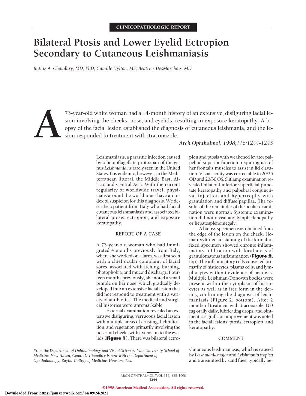 Bilateral Ptosis and Lower Eyelid Ectropion Secondary to Cutaneous Leishmaniasis