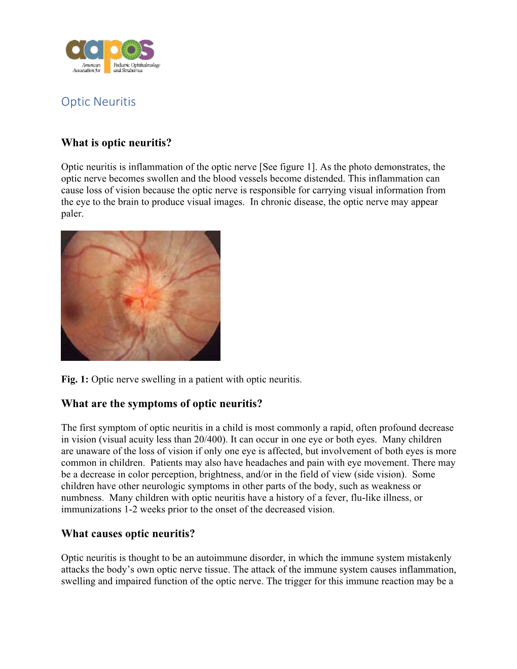 Optic Neuritis