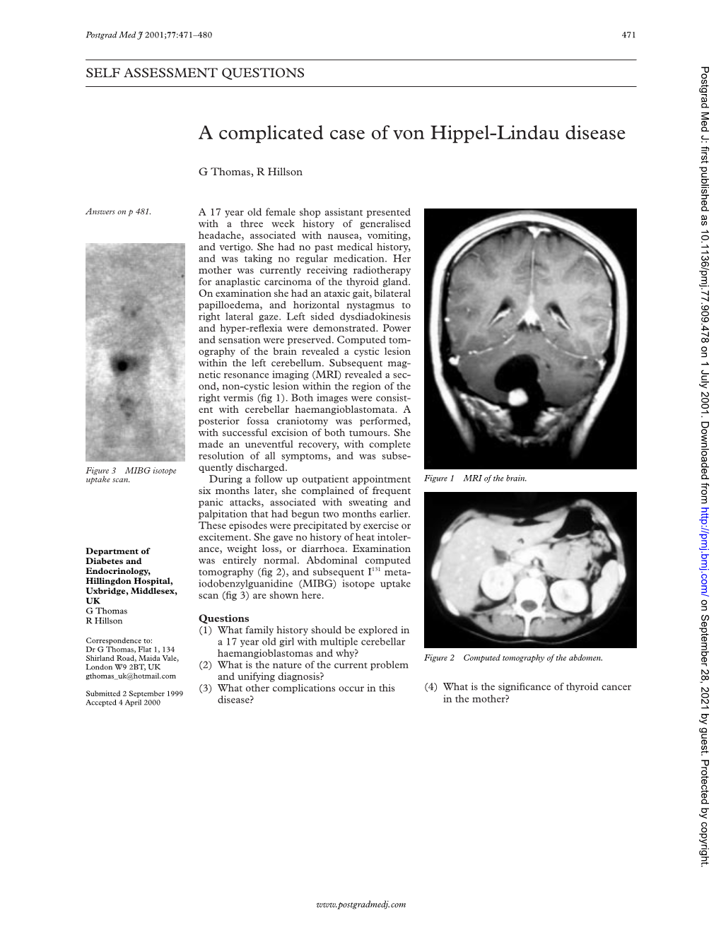 A Complicated Case of Von Hippel-Lindau Disease