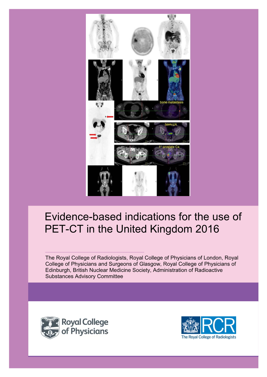Evidence-Based Indications for the Use of PET-CT in the UK 2016