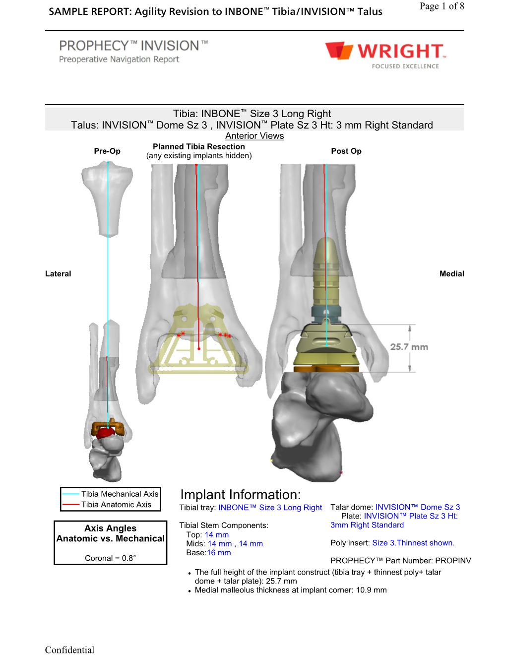 Implant Information